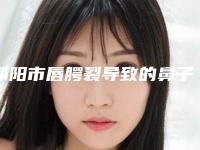 邵阳市唇腭裂导致的鼻子塌陷修复费用表明细官方曝光(近6个月均价为：39880元)