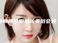 邯郸两个眼角长黄斑会对身体产生副作用吗