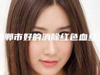 邯郸市好的消除红色血丝医院-邯郸金皇后医疗美容诊所位列前三