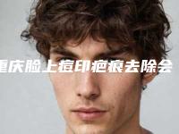 重庆脸上痘印疤痕去除会不会影响健康
