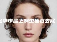 金华市脸上螨虫痤疮去除医院排行前十佳排行详解-金华金东区令颜医疗美容门诊部带来新体验