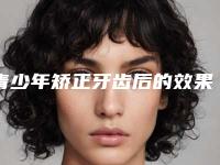 青少年矫正牙齿后的效果好看吗