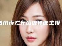 银川市烂牙齿拔掉医生排名前十名实力解读-银川市卢九宁口腔医生