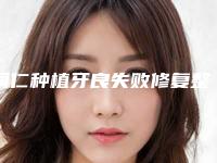 铜仁种植牙良失败修复整形术失败禁忌人群