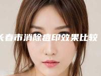 长春市消除痘印效果比较好的医院是哪家（长春市消除痘印整形医院）