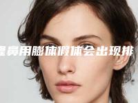 隆鼻用膨体假体会出现排斥反应吗（隆鼻用膨体假体会出现排斥反应吗图片）