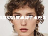 雪蓝贝假体丰胸手术效果不理想怎么办
