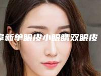 阜新单眼皮小眼睛双眼皮整形多少钱效果怎样