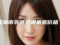 芜湖市乳牙牙根暴露价格(收费标准)2025分享，医院介绍一览-芜湖市乳牙牙根暴露价格