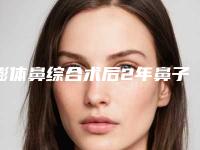 膨体鼻综合术后2年鼻子有点歪 取出重新做会导致鼻子变薄吗