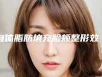 自体脂肪填充脸颊整形效果可靠吗