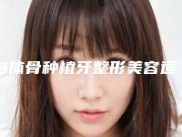 自体骨种植牙整形美容适合什么样的人做哪里靠谱