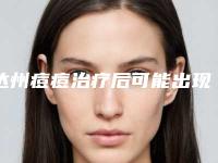 达州痘痘治疗后可能出现哪些后遗症