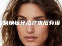 贺焕焕恒牙治疗术后有没有副作用