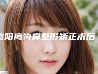 资阳鹰钩鼻整形矫正术后会有什么后遗症