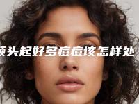 额头起好多痘痘该怎样处理额头长痘痘怎么去除