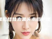 黑脸娃娃去黑头术后护理四大注意事项