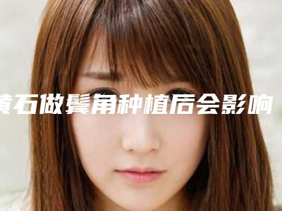 黄石做鬓角种植后会影响日常工作吗