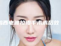 鸡西电波拉皮手术术后效果如何